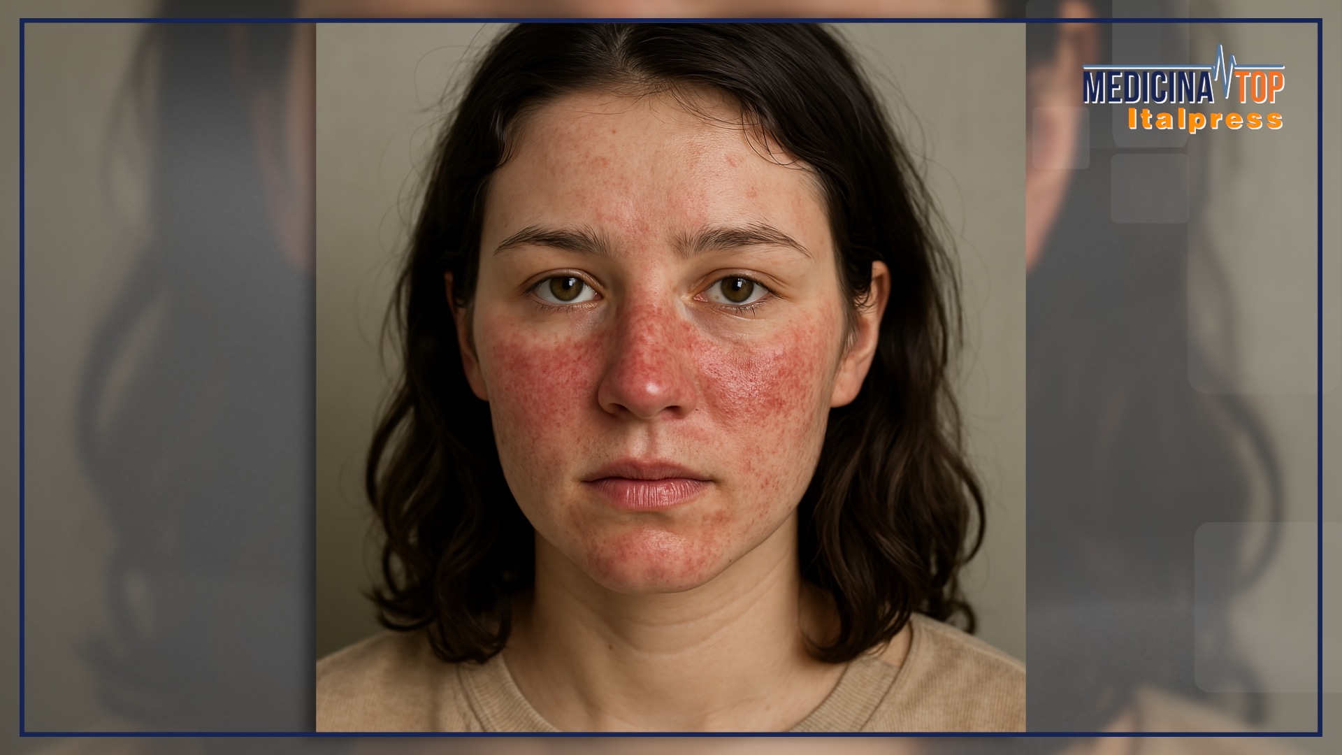 lupus, passi in avanti nella cura di una malattia difficile da individuare ‣ adn24 14